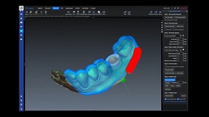 Planmeca Romexis imaging software provides a unique platform for capturing data, diagnosis and treatment planning. Providing a place for all patient data and developed in house to increase patient care. With 200,000 users worldwide, this open platform is easy to use and a powerful tool for patient education. For more information: https://www.plandemo.co.uk/ #dentistry #planmeca #imagingsoftware #dentalimaging #dentalimagingsoftware | Dentistry