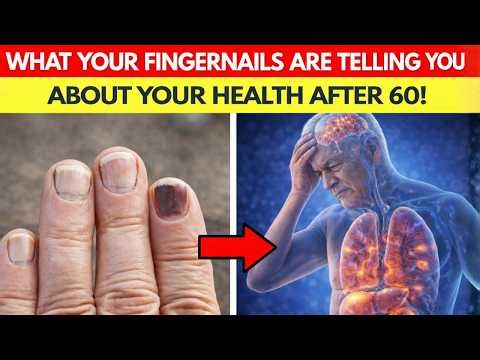What Your Fingernails Are Trying to Tell You About Your Health After 60