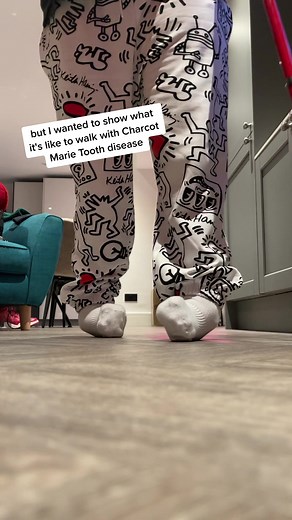 Walking Experience with Charcot Marie Tooth Disease