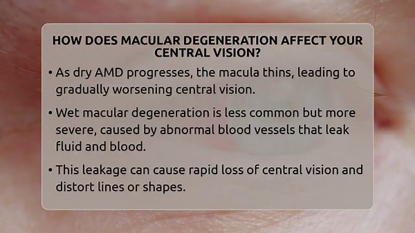 How Does Macular Degeneration Affect Your Central Vision? - Optometry Knowledge Base