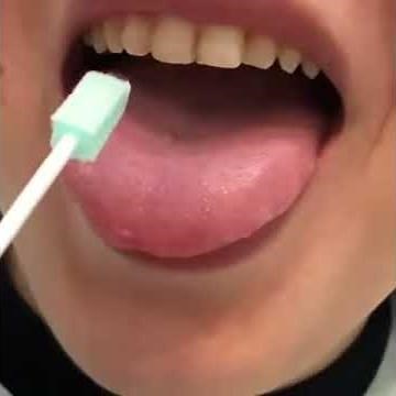 ADCHECK アドチェック （歯周病原因菌酵素活性測定キット）施術動画