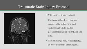 Concussion Evaluation: Early Signs, TBI Management, Assessment Tools and Protocols
