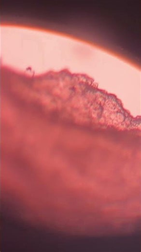 Nail Under Microscope 🔬