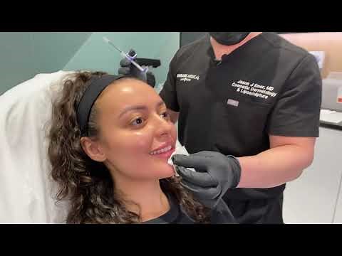 FEMALE RUSSIAN LIP TENTING TECHNIQUE | KEYHOLE POUT PLUMP FILLER INJECTION | Dr. Jason Emer