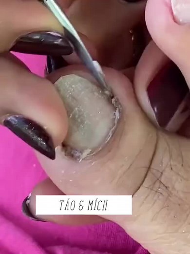 Chăm sóc móng chân tại nhà dễ dàng