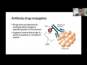 Stomach Cancer Webinar: IGCC + ASCO + ESMO GI 2025 Review