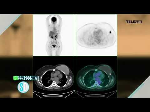 🌀🔊 Why does the CT scan make so much noise?