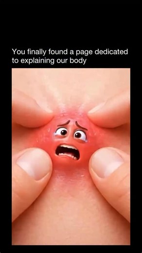 Explaining Our Body on Instagram: "Popping pimples usually makes things worse, even if it feels satisfying in the moment. When you squeeze a pimple, you can push bacteria and oil deeper into the skin, which increases inflammation and makes the breakout last longer. It also raises the risk of scarring and dark marks that can stick around for months. Even “ready” looking whiteheads can reopen and get infected, turning a small spot into a bigger problem. If a pimple is bothering you, it’s better to