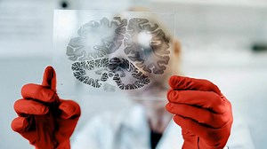 How to Reduce Toxic Tau Protein and Lower Alzheimer's Risk