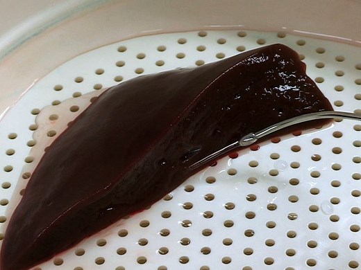 Isolation of Human Hepatocytes by a Two-step Collagenase Perfusion Procedure