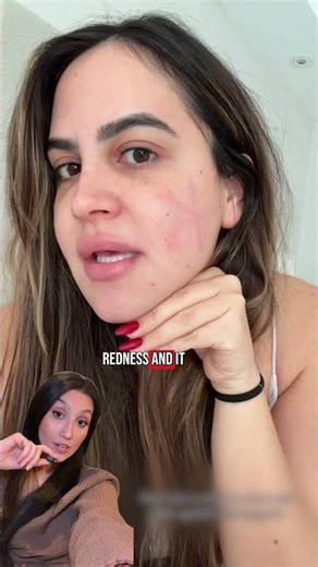 Ever scratched your skin and noticed a raised red line appear a few seconds later?