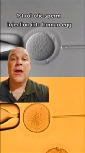 50K views · 648 reactions | human vs robot controlled fertilization of human egg #embryo #robot #infertility #IVF #ttc #infertilitywarrior #ivfwarrior #infertilityjourney #Reels #reelsvideo #reelsviral #reelinstagram | Steven Palter | Facebook