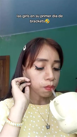 Las chicas en su primer día de brackets: ¡Momentos divertidos!