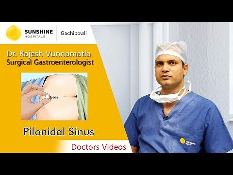 Pilonidal Sinus | Dr. Rajesh Vunnamatla | Advanced Laparoscopic Surgeon