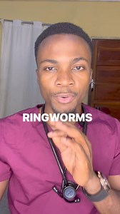 44K views · 975 reactions | What are ringworms? #ringworm #Fungalnailinfections #healthtips #fypviralシ #reelsfacebook | Ignicious Kachingwe | Facebook
