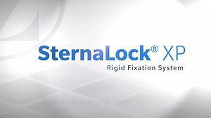 SternaLock® XP Rigid Fixation System Animation