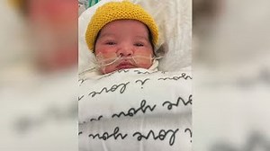 A Las Vegas child who was nicknamed "Baby Incredible Hulk" has died after a battle with a rare genetic disorder. STORY: https://bit.ly/3kTQulz | FOX5 Las Vegas