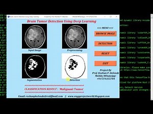 Python Code for Brain Tumor Detection Using Deep Learning Neural Network Full Source Code