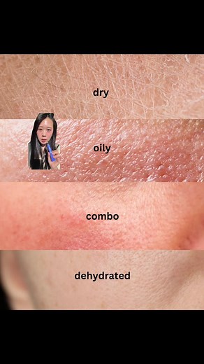 How to Determine Your Skin Type Easily