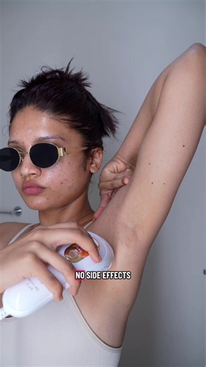 My Experience with At-Home IPL Hair Removal