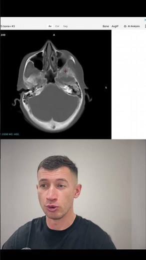 DICOM Viewer Tools: MPR, Windowing, MIP & Annotations in Your Browser