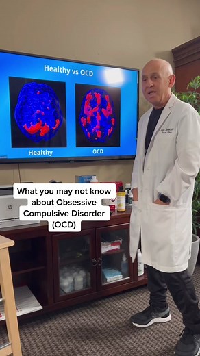 Today, were showing brain scans of someone who has #OCD. #fyp #foryoupage #braintok #mentalhealth