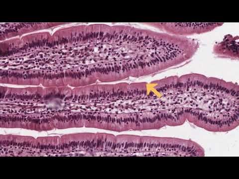 Simple Columnar Epithelium