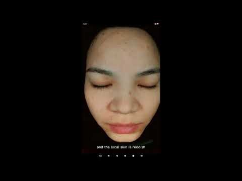 How to use Q1 Skin analysis machine