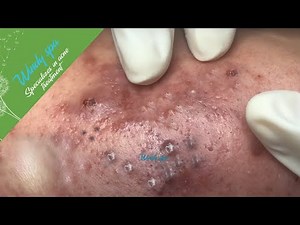 Make Your Day Relaxing with Windy Spa 6#143