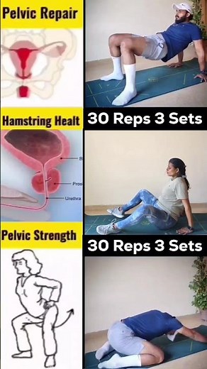 Pelvic Repair & Hamstring Recovery: Doctor-Approved Exercises You Need#shorts