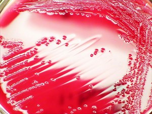 What is Shigella? Classification/Characteristics, Location, Gram Stain