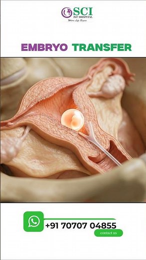 Embryo Transfer Explained | What Happens During Embryo Transfer? | #embryotransfer