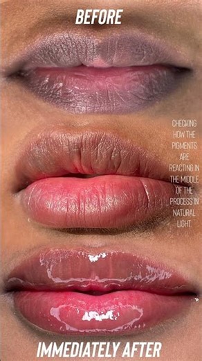 Dark lip neutralization session 1.