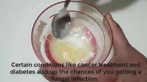 36K views · 430 reactions | Fungal infection treatment at home | Life Care Tips | Facebook