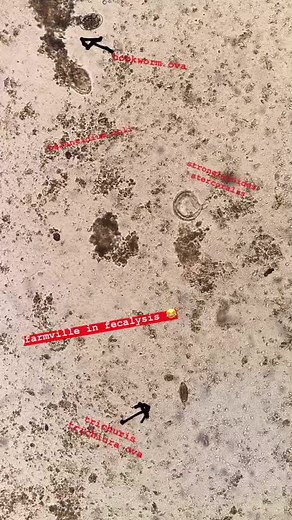 Exploring the Microscopic World of Fecalysis: A Detailed Look at Stool Samples