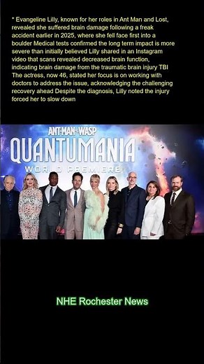 Evangeline Lilly, known for her roles in "Ant-Man" and "Lost," revealed she suffered brain damage fo