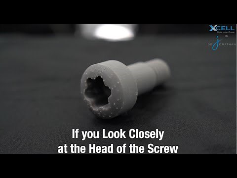 Xcell Dental Implants: What is the PowerBall Screw?