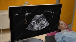 Examination ultrasound device scanning the stomach of the pregnant female. Examination ultrasound device analysing the children. Examination ultrasound device displays the twins in the patients womb.