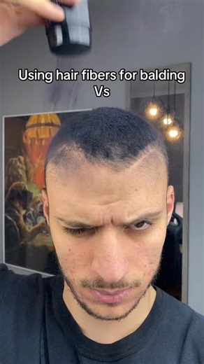 Just use Rooty bro 😎 | Rooty