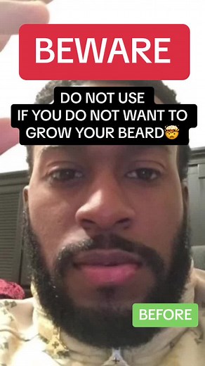 Essential Tips for Beard Growth and Care