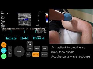 Ultrasound Tutorial: DVT / Lower Limb Veins | Radiology Nation • Video • MEDtube.net