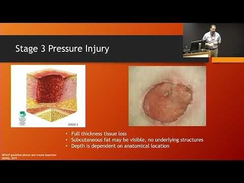 Wound Care: A Team Approach and An Overview of Hyperbaric Oxygen Therapy 12/4/19