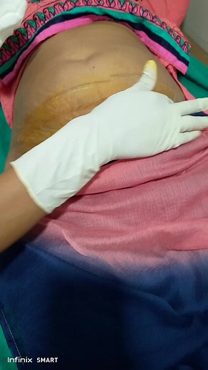 Understanding Pregnancy Abdominal Checks