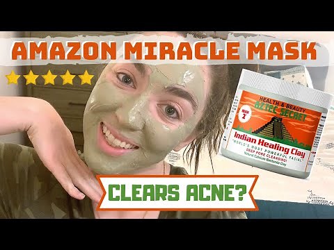 Aztec Healing Clay Mask 7-Day Challenge (BEFORE + AFTER)