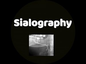 Sialography