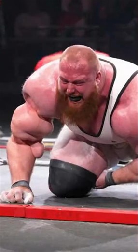 "Weight Lift Fail – His Bicep Balloons Red Instantly 😱 Horrific Injury!" #viral #shorts #fyp