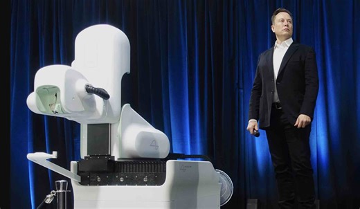 Neuralink Set to Launch ‘High-Volume’ Brain Implant Production as Competitors Weigh In