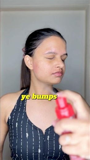 I Tried HOCl Spray for 7 Days My Skin Shocked Me 😱#shorts #ytshorts #withyashaswii