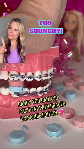 Candy You Can and Can't Eat with Braces on Barbie Edition