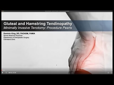 TenJet Gluteal and Hamstring Tendinopathy Procedure Technique and Pearls